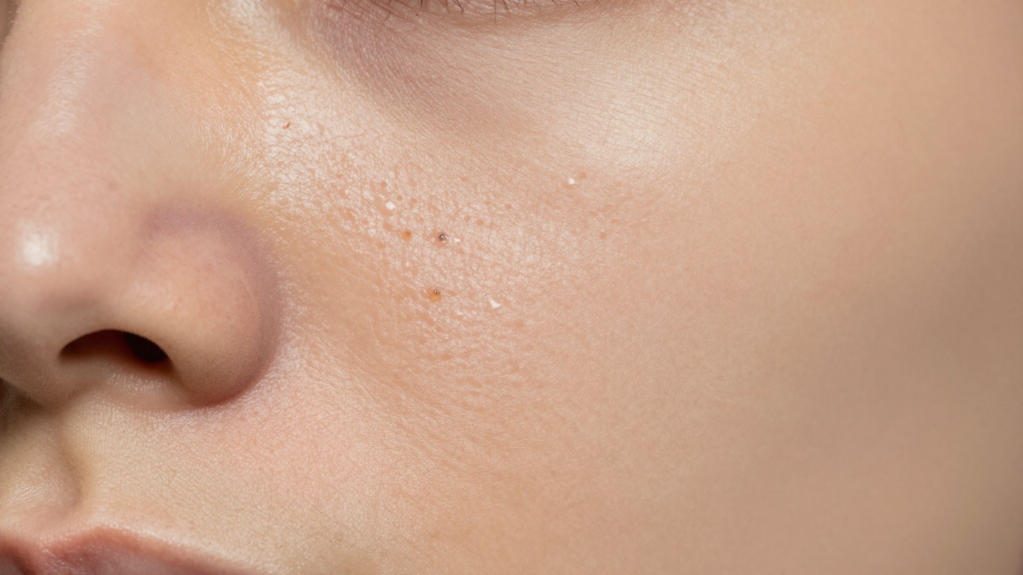 A Paraffinum Liquidum eltömítheti a pórusokat és mitesszereket okozhat.