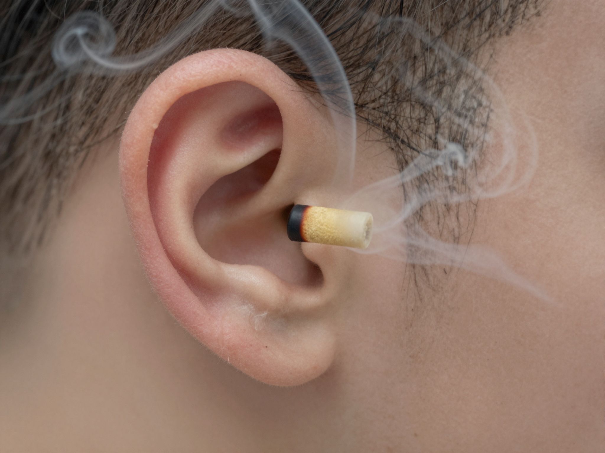 A fülgyertya égési sérülést és halláskárosodást is okozhat.